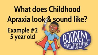 Childhood Apraxia of Speech  Example 2 [upl. by Atirma]