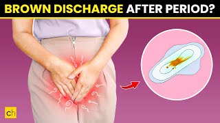 How To Stop Brown Discharge After Period  Causes amp Natural Remedies [upl. by Winnie715]