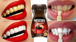 In Just 2 Minutes  Turn Yellow Teeth To Pearl White and Shine  Coffee For Teeth Whitening at Home [upl. by Aicertap662]