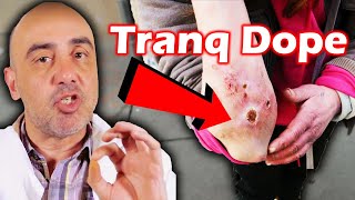 What Is Tranq Dope The Dangerous New Drug On The Streets [upl. by Andreas]