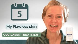 5 Days to FLAWLESS Skin with CO2 Laser Treatment [upl. by Shipp]