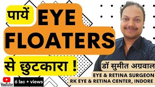 What are Eye Floaters  आई फ्लोटर्स से पाएं छुटकारा [upl. by Naahs]