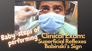 Superficial Reflexes  Babinskis  2nd Prof MBBS Practical English Urdu Hindi [upl. by Kreiker509]