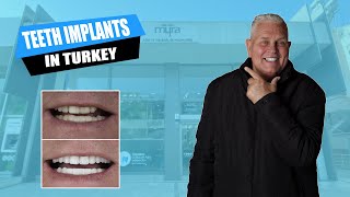 Teeth Implants in Turkey Review 2022  IS IT WORTH IT veneersturkey teethturkey implantsturkey [upl. by Anirav]