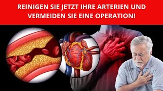 REINIGEN SIE JETZT IHRE ARTERIEN UND VERMEIDEN SIE EINE OPERATION [upl. by Palermo]