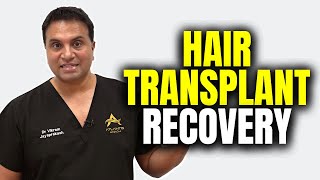 What To Expect After A Hair Transplant [upl. by Burr]