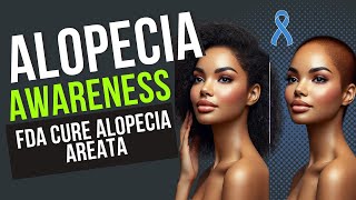 The FDA APPROVED Solution to Alopecia Areata Treatment [upl. by Devinne]