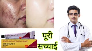 Betnovate C Cream HONEST review 2022 In Hindi  How To Use Betnovate C Cream [upl. by Sussna]