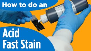 How to do an AcidFast Stain  Instructions for the labprocedure [upl. by Iruahs]