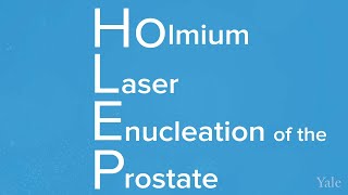 HoLEP Procedure Helps Alleviate BPH [upl. by Nauqet126]