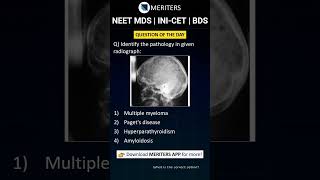 NEET MDS  INICET MDS  PSC  BDS  Most Important Questions neetmds2025 mdsprep [upl. by Pryce]