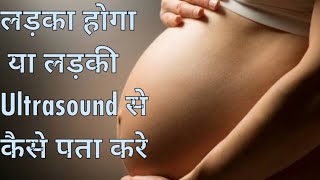 Anterior placenta  Posterior placenta Ultrasound से कैसे पता करे कि बेटा होगा या बेटी।। [upl. by Llatsyrk]