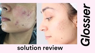 Glossier Solution Review [upl. by Elwina]