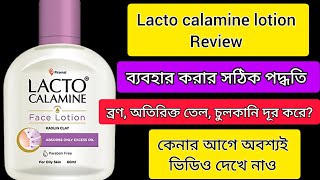 Lacto calamine face lotion reviewLacto calamine face lotion review in Bengali [upl. by Townsend]