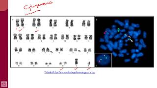 Hematology  2  U2L35  Cytogenetics [upl. by Hardej40]