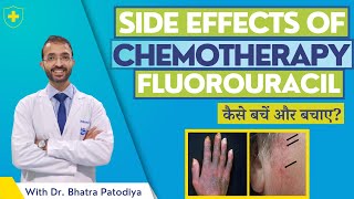 Fluorouracil  Side Effects Of Chemotherapy  Avoid With Easy 7 Steps  Dr Bharat Patodiya [upl. by Soalokin410]