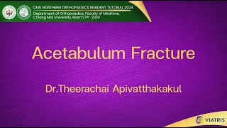 Acetabulum Fracture [upl. by Anuska314]