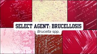 Morphology Moments  Brucella [upl. by Arreip410]