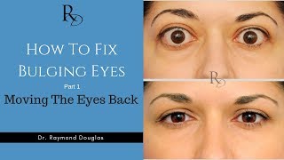 How To Fix Bulging Eyes  Part 1  Moving The Eyes Back [upl. by Adnert]