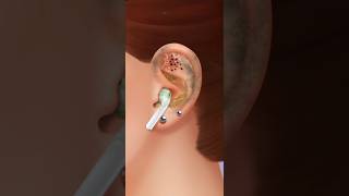 ASMR ear treatment  remove earbuds amp piercing animation clean earwax and worm [upl. by Moise429]