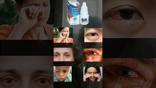 mahaflox eye drop uses in hindi mahaflox eye drops uses  mahaflox shorts viralvideo facts [upl. by Bathulda392]