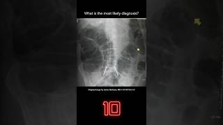 Abdominal Xray Question 2 [upl. by Ainimreh866]