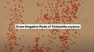 Klebsiella oxytoca in Gram Staining [upl. by Auohp]