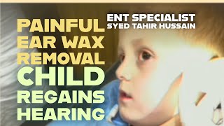 Hearing Restored in Child After Removal of Painful Ear Wax Blockage [upl. by Aryt]