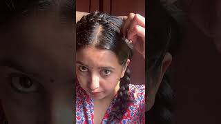 3 CUTE HAIRSTYLES FOR YOUR OILY HAIR DAYS  Shorts  Hair Care Tips  Magic Pill [upl. by Illek]