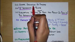 What is rheumatoid arthritis Part 2 clinical featuresarticular and extra articularinvestigations [upl. by Dachy53]