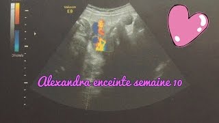 Alexandra enceinte  semaine 10 [upl. by Aromas]