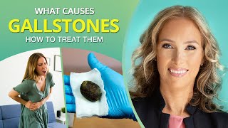 What Causes Gallstones amp How to Treat Them  Dr J9 Live [upl. by Pickard]