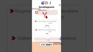 SerodiagnosisGiardia lamblia parasitology microbiology pathology diagnosis neetpg neet [upl. by Elberfeld97]