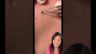 Some great blackheads and DPOWs on the back [upl. by Culver]