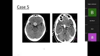 CNS Spotting lecture 2 part 1 [upl. by Ainet]