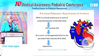 Pediatric Arterial Pulmonary Hypertension Prof Hala Agha [upl. by Anpas]