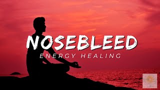 Nosebleed Energy Healing  Healing at Hand [upl. by Isle]