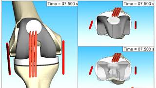 Knee joint kinematics during flexionextension have been analyzed via Multibody Simulation SIMPACK [upl. by Zuleika]