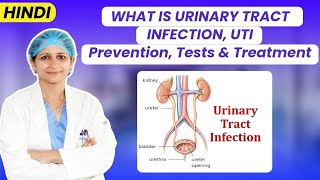 Understanding UTIs in Women Symptoms Causes and Treatment  Dr Jyoti Gynecologist [upl. by Nnylsaj]