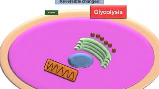 Cell Injury Reversible Changes [upl. by Anilrats]