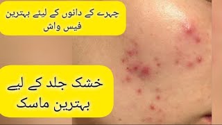 Acne Treatment at home  Chehray k daano ka best totka  Mask for dry Skin  blessed kitchen [upl. by Hyacinthe]