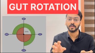 Gut Rotation Anatomy Malayalam LectureOmphalocele [upl. by Nelleoj]