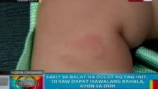 BP Sakit sa balat na dulot ng taginit di dapat isawalang bahala ayon sa DOH [upl. by Ring454]