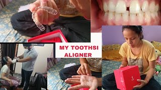 My Toothsi Aligner Day 1Unboxing of Toothsi AlignerBraces Precaution in IndiaToothsi [upl. by Ayn258]