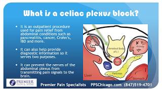 Celiac Plexus Block with a Chicago Pain Management Clinic 847 5194701 [upl. by Tseng]