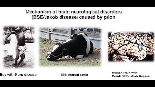 Mechanism of brain neurological disorders BSEJakob disease caused by prion proteins [upl. by Bertha]