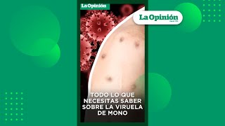 Viruela del mono ¿Cómo se contagia la mpox  La Opinión [upl. by Kynan]