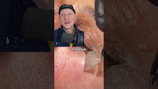 Chemical Peel Skin PEELING  Plastic Surgeon Reacts [upl. by Sherye422]