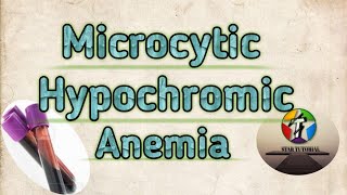 Microcytic Hypochromic Anemia in hindi ll ANEMIA ll Hematology And Blood Banking [upl. by Uaerraj266]