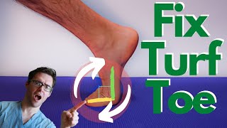 Turf Toe Injury BEST Treatment Causes Symptoms amp 3 Grades [upl. by Pega214]